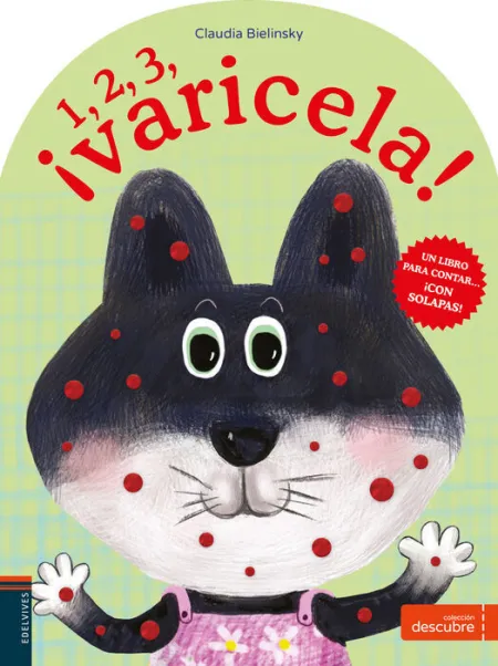 1, 2, 3... ¡Varicela!